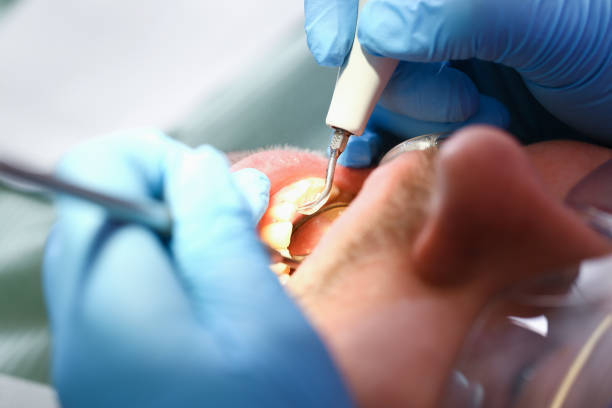 Best Emergency Tooth Extraction  in St Matthews, KY